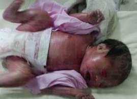 高龄女性做试管选哪代好 各代试管成功率分别有多少