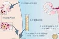 上饶市妇幼保健院做试管助孕成功率，助孕5万够吗？